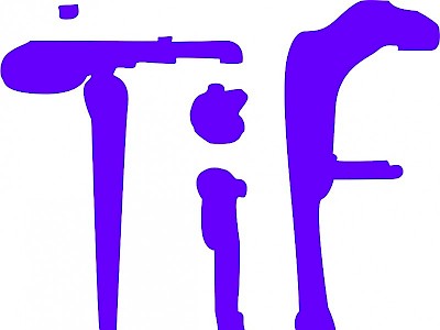Trust in Fife are looking for a Residential Support Worker